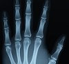 image: x-ray